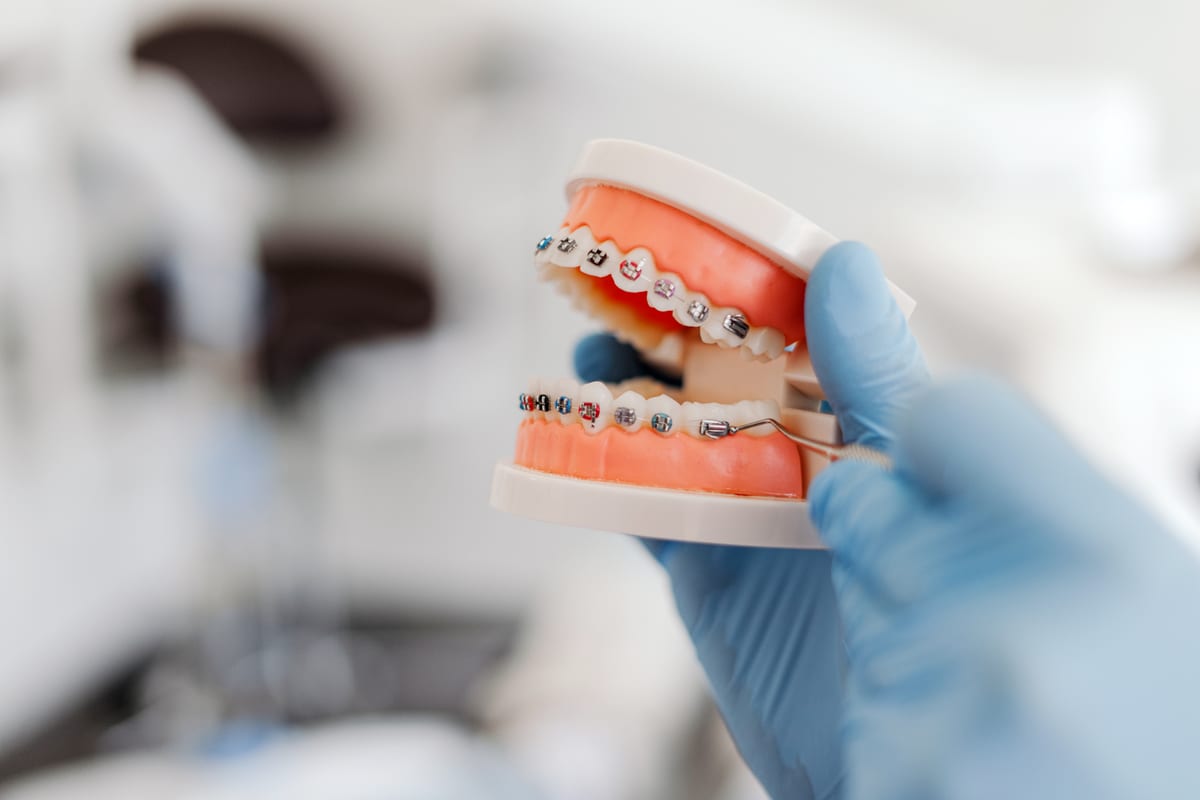 Orthodontics in Denver